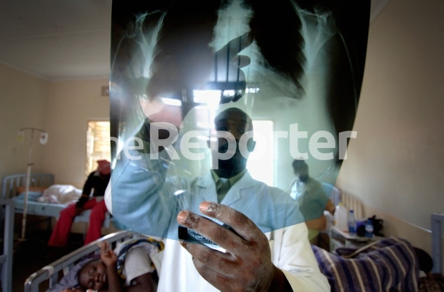 TB infections escalate