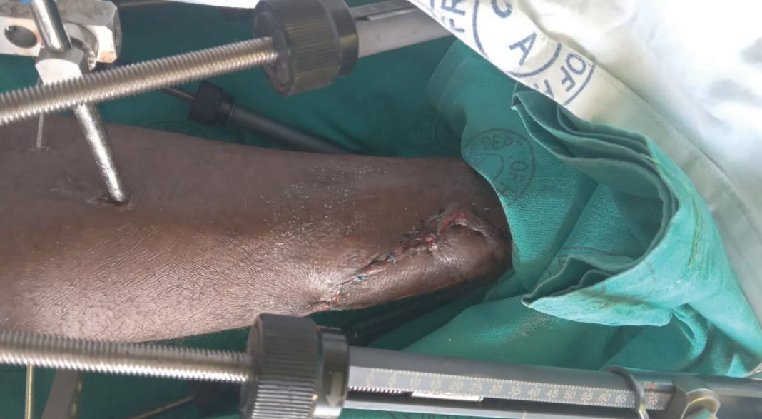 Torture victim demands M5m