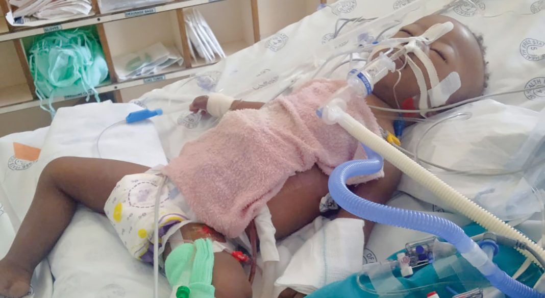 Down’s Syndrome baby triumphs