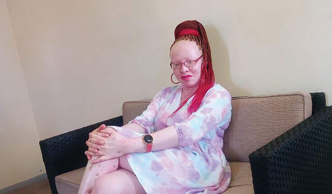 LNFOD celebrates Albinism Awareness Day